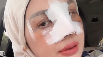 Elly Sugigi Mantapkan Perjalanan Estetika: Gigi dan Facelift Jadi Prioritas Berikutnya