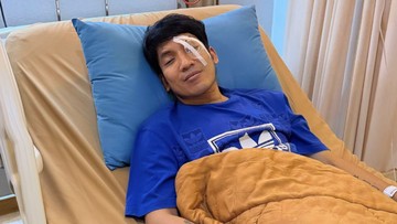Cedera Tak Terduga Saat Bermain Padel, Desta Jalani Operasi Darurat di Mata Kiri